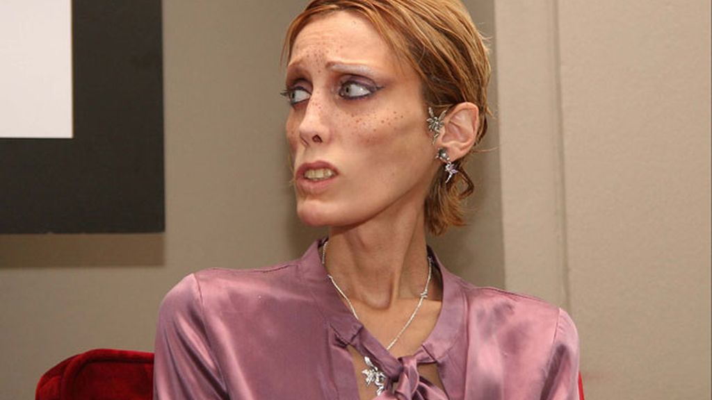 Combatiendo la enfermedad desde los 13 años