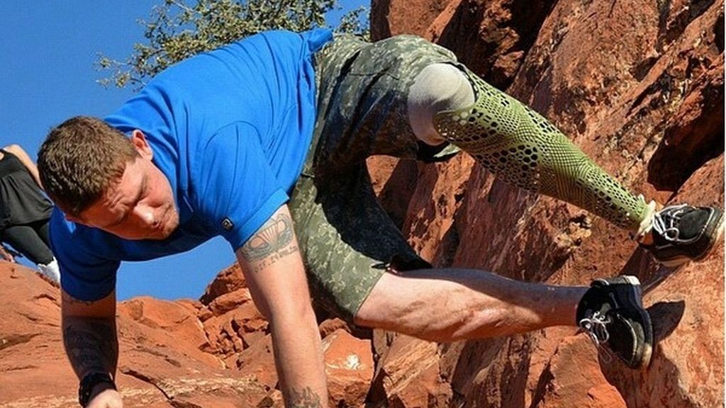 Moda y prótesis, de la mano