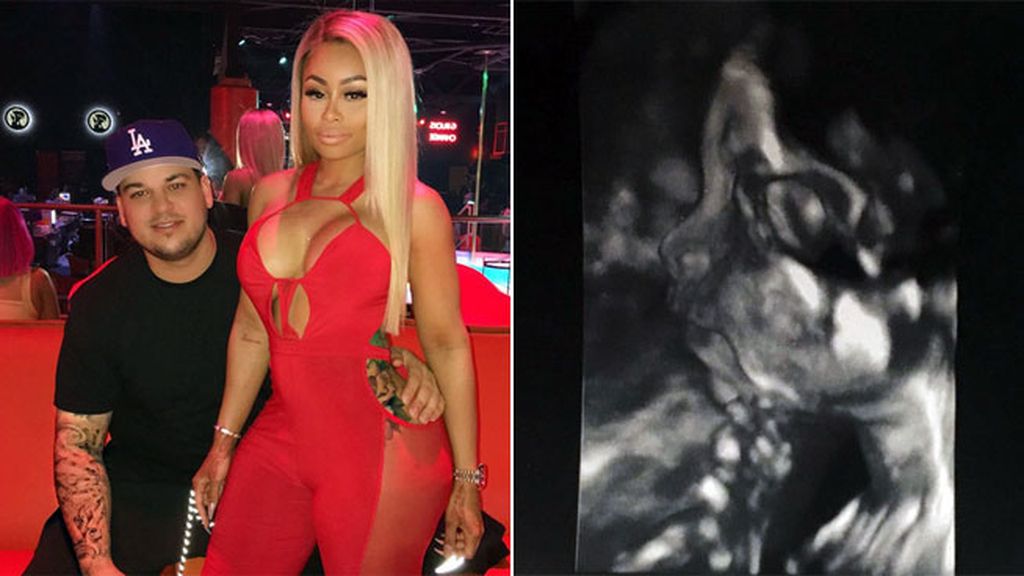 Blac Chyna y Rob Kardashian “no pueden esperar más para conocer a su niña”