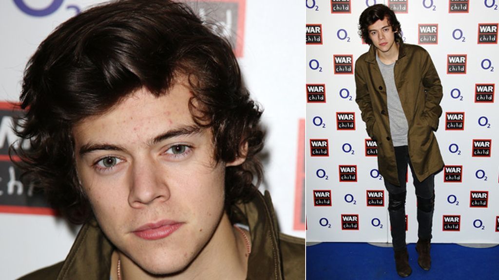 Harry Styles, según declararon fuentes, sigue enamorado de su ex, Cara Delevingne