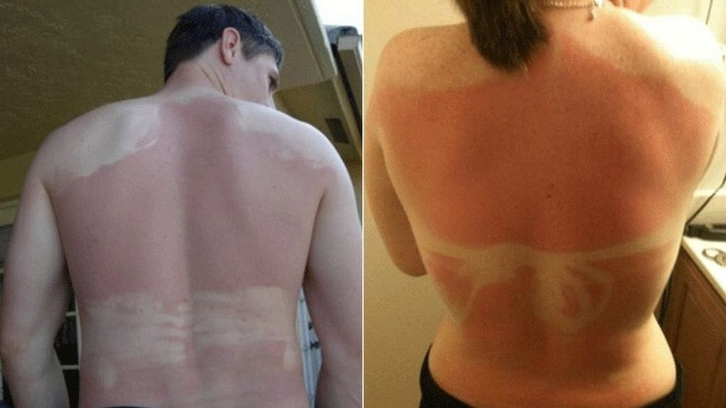 Cuando el sol te marca