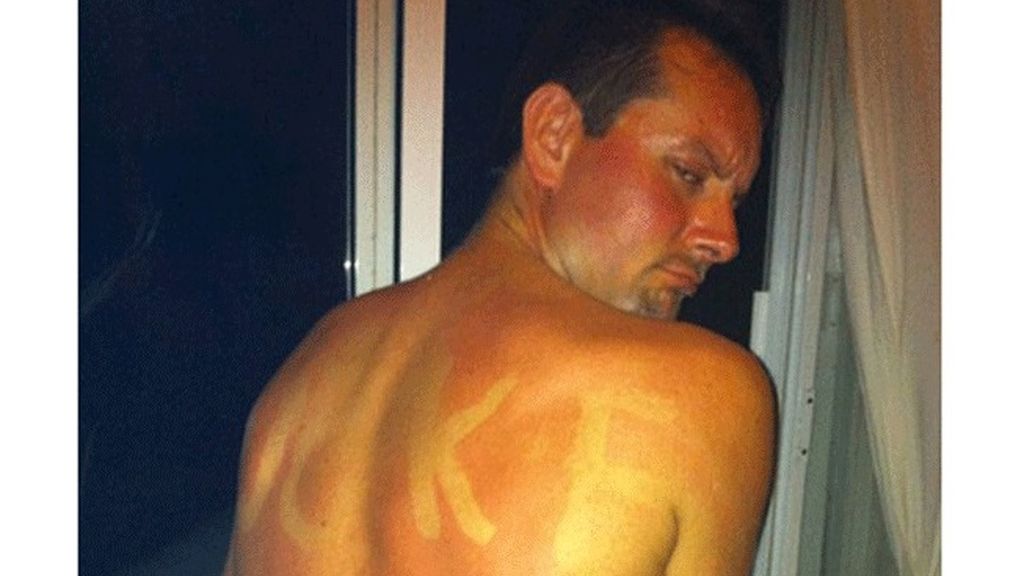 Cuando el sol te marca