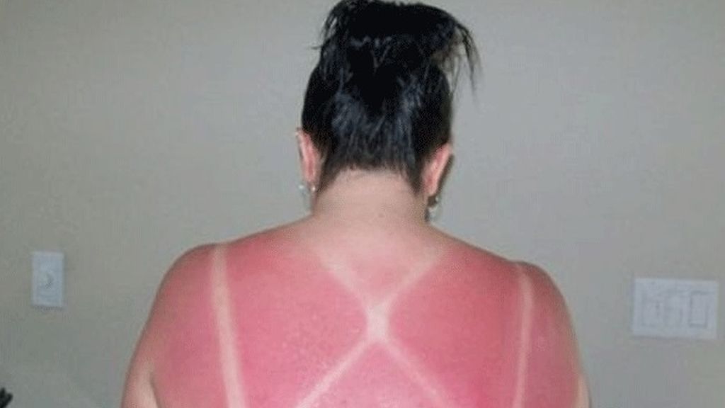 Cuando el sol te marca