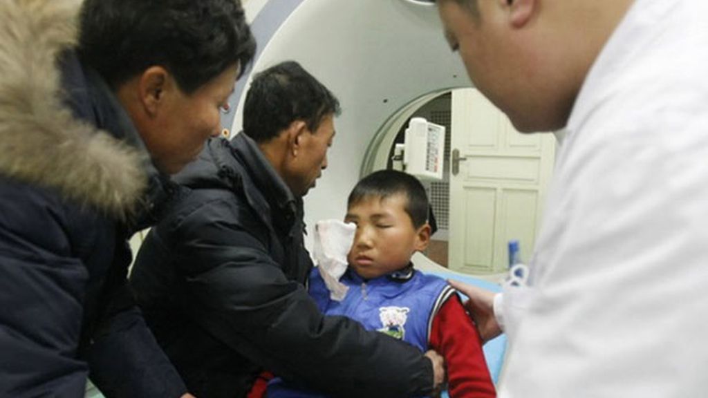 Se clava un gancho en un ojo