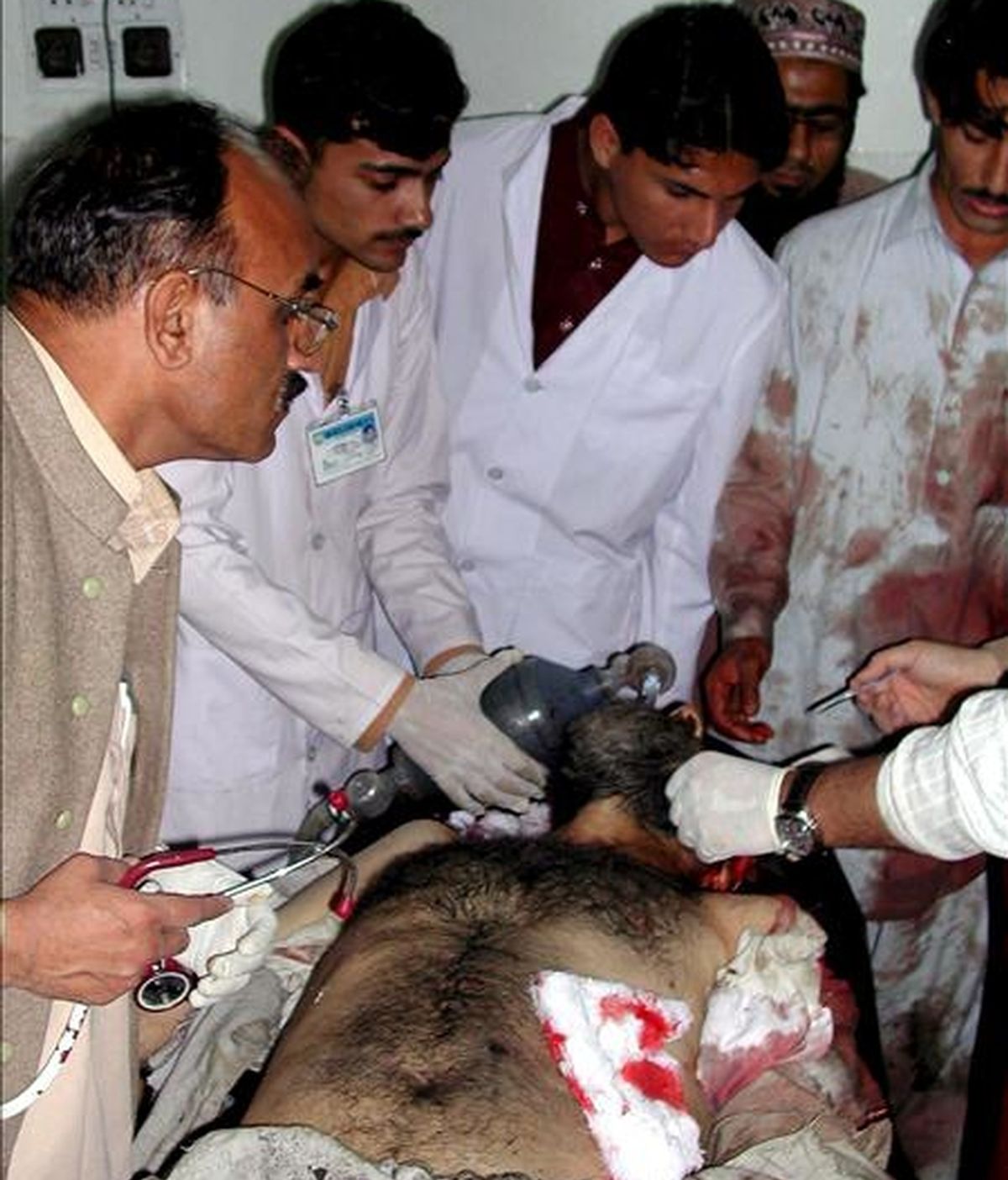 Uno de los heridos en un ataque suicida llevado a cabo en el centro policial de Tangi, provincia de Charsadda, recibe tratamiento médico en un hospital de Peshawar, capital de la Provincia de la Frontera del Noroeste (NWFP), Pakistán, el pasado 15 de abril. EFE