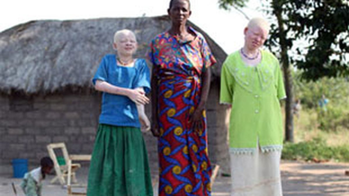 Mary Mathias junto a sus dos hijas albinas. Foto: The Sun.