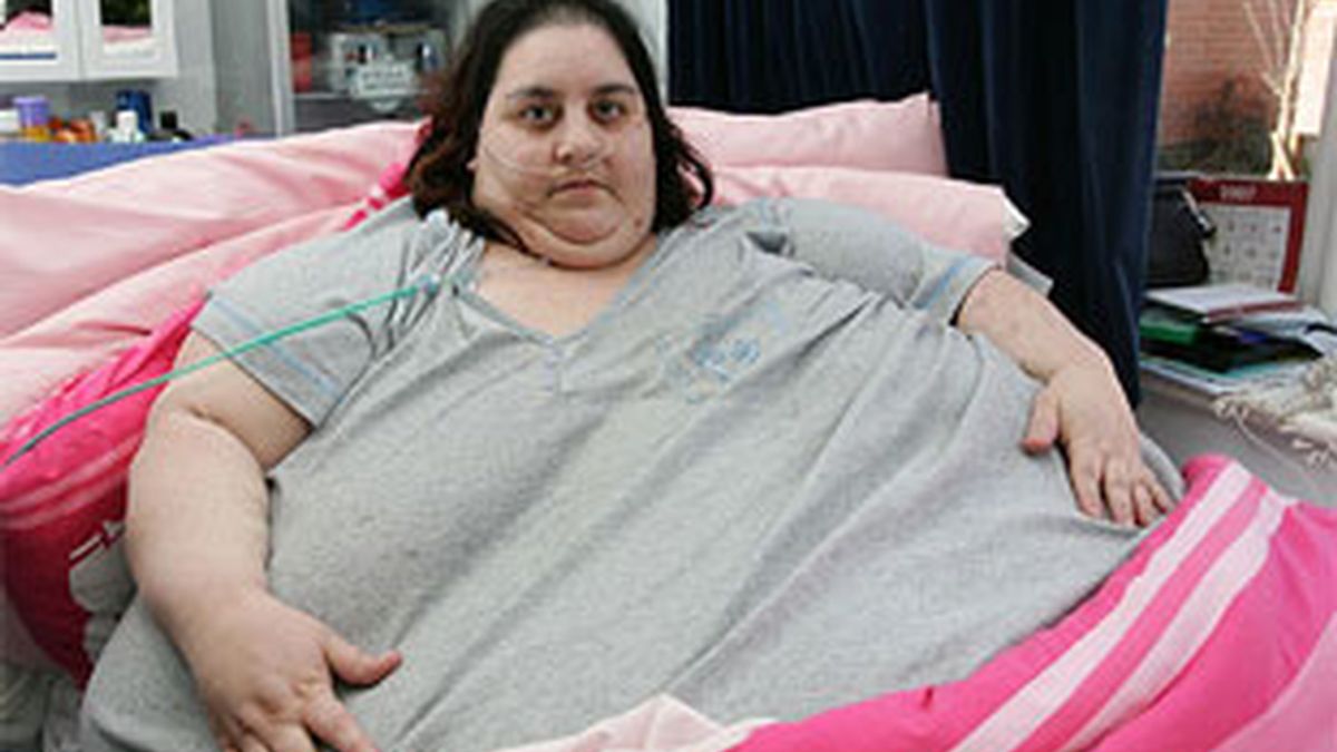 Sharon vive postrada en una cama con respiración asistida. Foto: The Sun