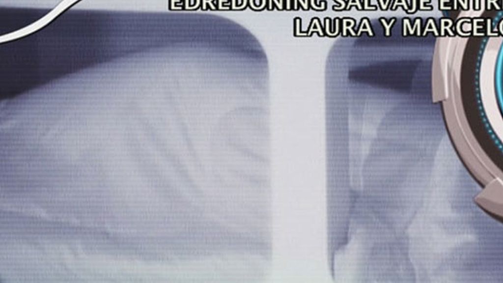 ¡Laura y Marcelo hacen edredoning!