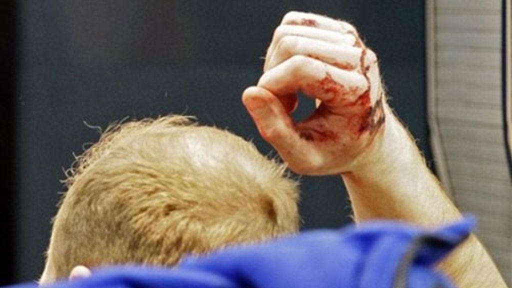 UNO DE LOS AFECTADOS