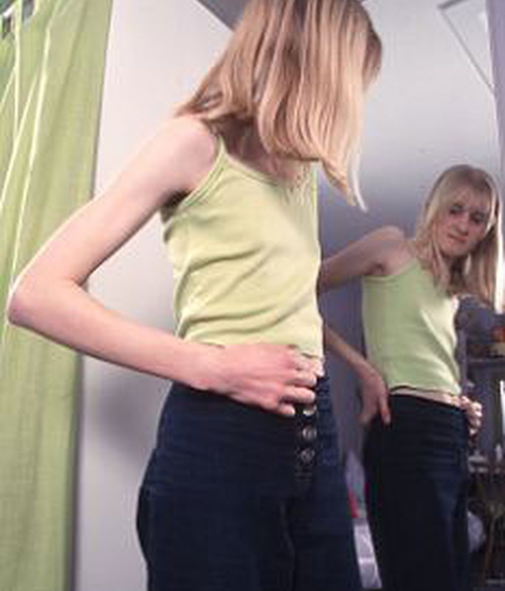 La anorexia y la bulimia la padecen cada evz chicas más jóvenes. La anorexia y la bulimia la padecen cada evz chicas más jóvenes.