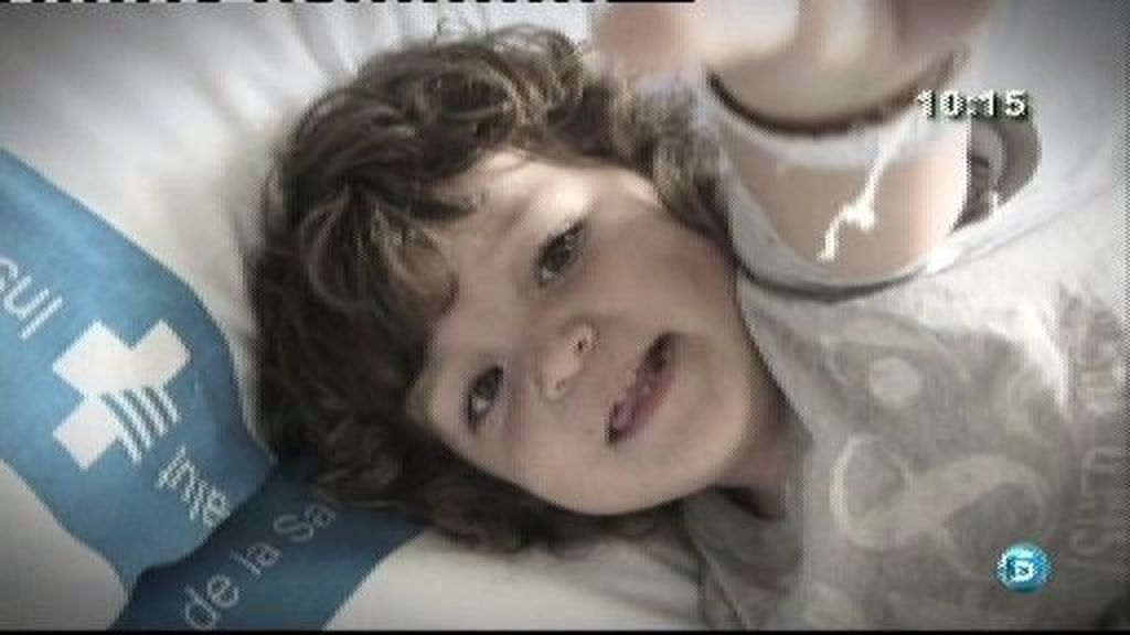 Nacho sufre la enfermedad de Dent