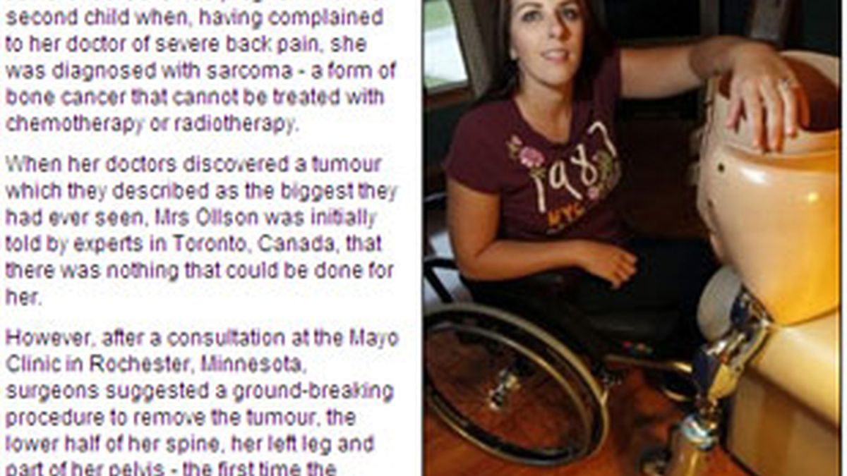 Imagen de Janis tras la operación. Foto: Daily Mail.