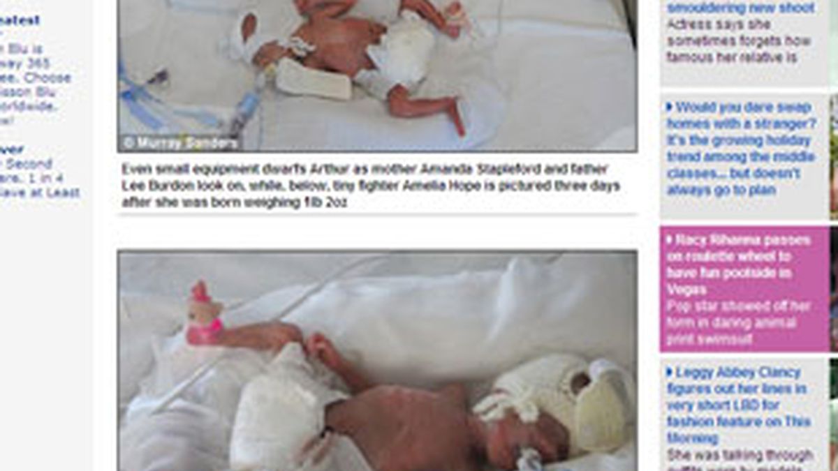 Los gemelos se recuperan en un hospital de Reino Unido. Foto: Daily Mayl