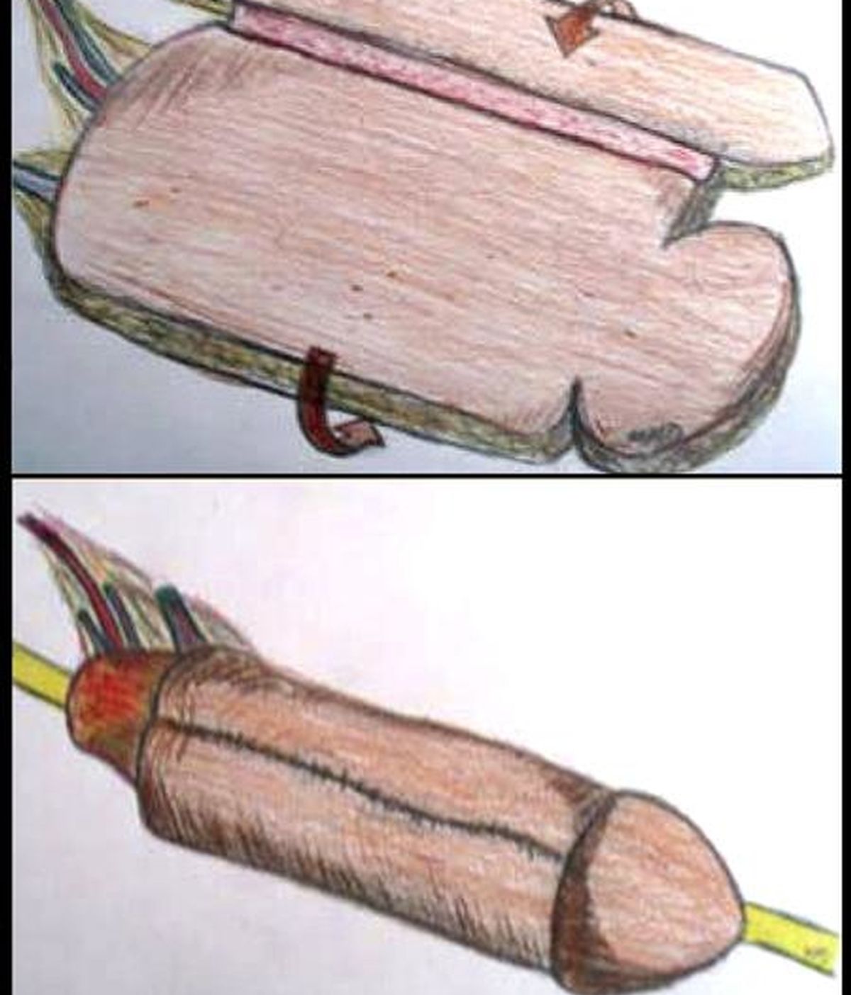 Ilustración facilitada por la CAM que muestra la intervención realizada, por primera vez en España, por especialistas del Servicio de Urología y de Cirugía Plástica del Hospital Universitario 12 de Octubre que han realizado una reconstrucción completa de pene con implante de prótesis a un paciente de 41 años de edad con carcinoma. EFE Ilustración facilitada por la CAM que muestra la intervención realizada, por primera vez en España, por especialistas del Servicio de Urología y de Cirugía Plástica del Hospital Universitario 12 de Octubre que han realizado una reconstrucción completa de pene con implante de prótesis a un paciente de 41 años de edad con carcinoma. EFE