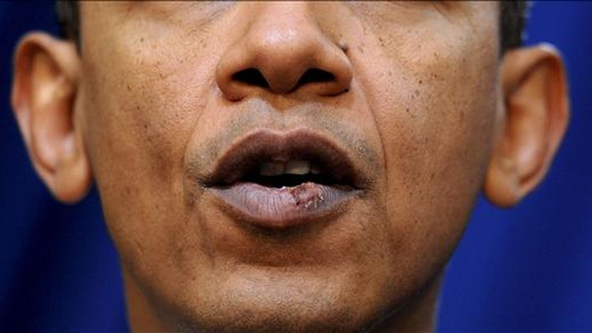 Detalle de los labios del presidente estadounidense, Barack Obama, durante una rueda de prensa, el pasado 30 de noviembre. Obama resulto herido el fin de semana, tras recibir un codazo, cuando jugaba baloncesto. EFE/Archivo