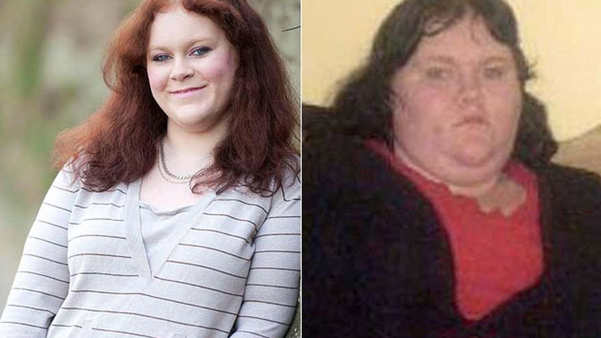 Jeniffer Hogarth pierde 63 kilos en un año gracias a la banda gástrica