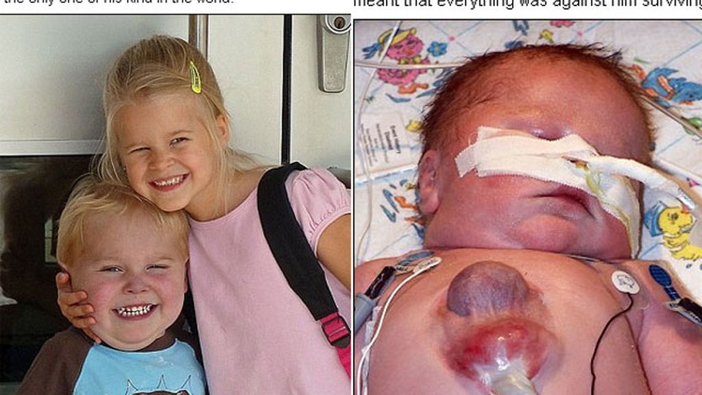 Sobrevive con el corazón fuera del pecho