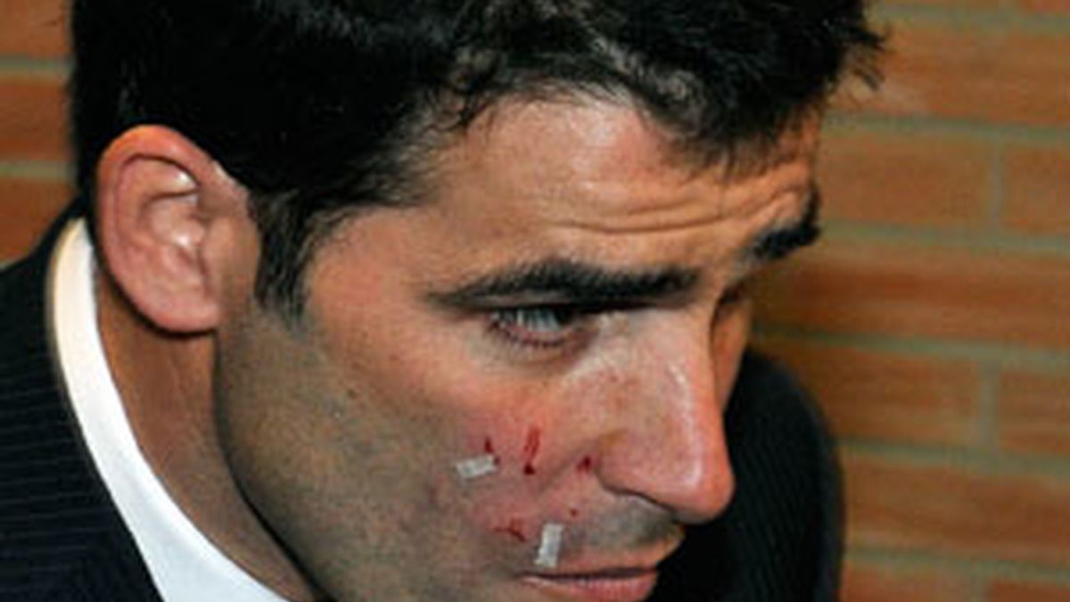 Javier Rodríguez Aguilar sale del estadio de Los Cármenes con las marcas de la agresión en su rostro. Foto: EFE