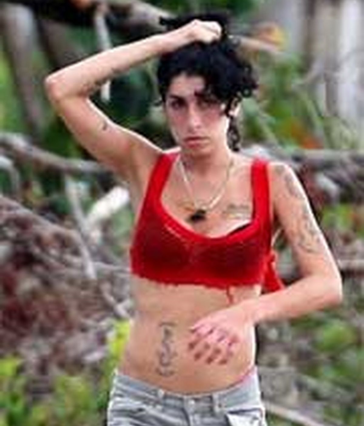 Amy Winehouse paseando con las quemaduras al aire por la isla. Foto de Dailymail.com