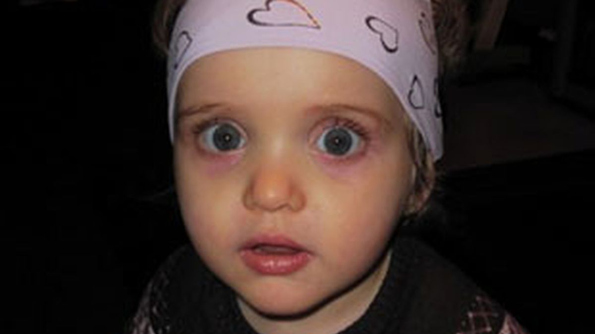 Ainhoa, de 17 meses, sufre un grave problema neuronal. Foto: Facebook