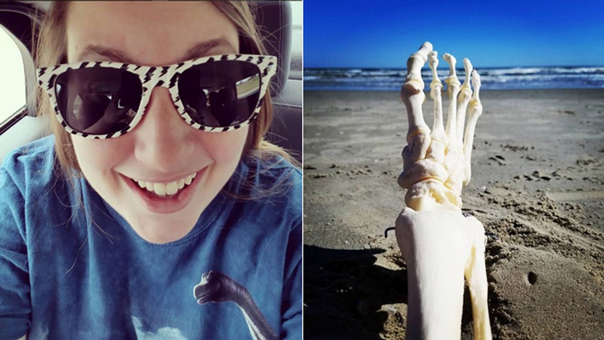 Las aventuras de una joven tras superar el cáncer junto a su pie amputado cautivan Instagram Las aventuras de una joven tras superar el cáncer junto a su pie amputado cautivan Instagram