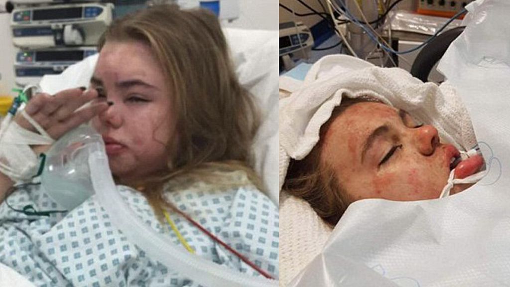 Comparte una foto de su hija en coma para alertar de las 