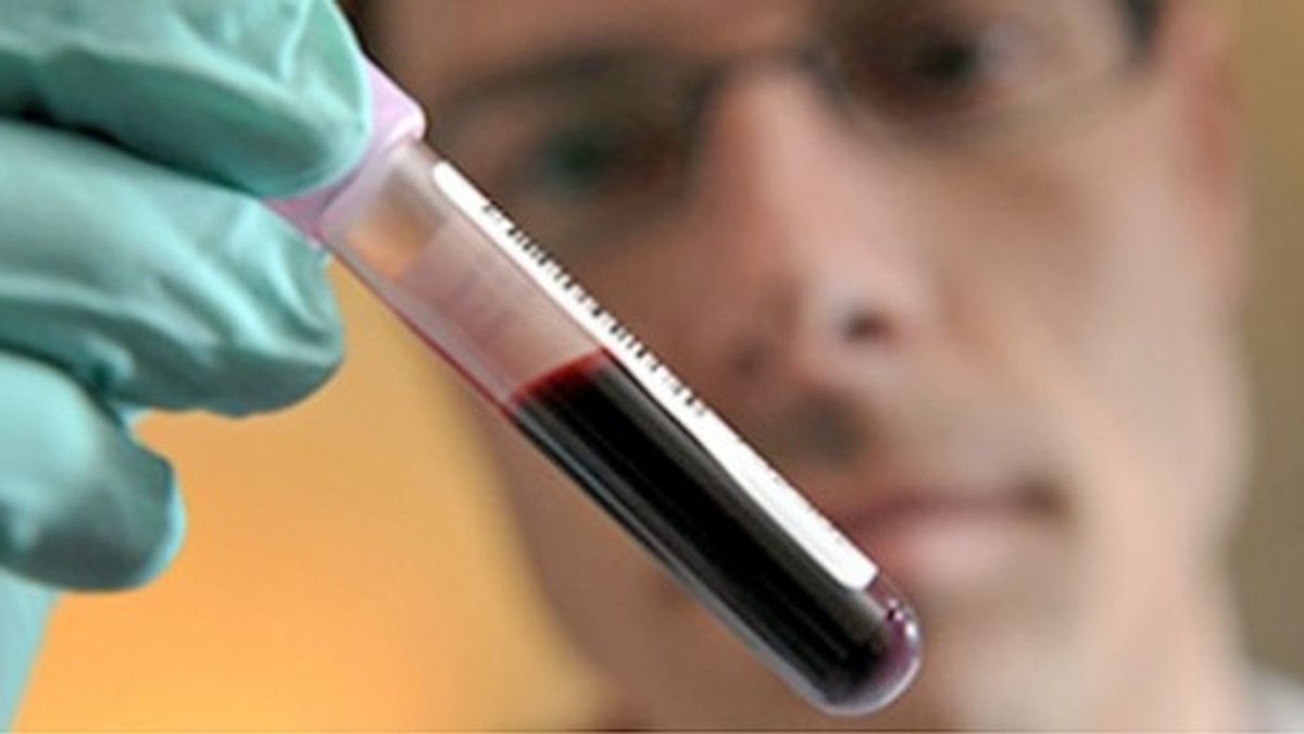 Imagen de archivo de un test de sangre