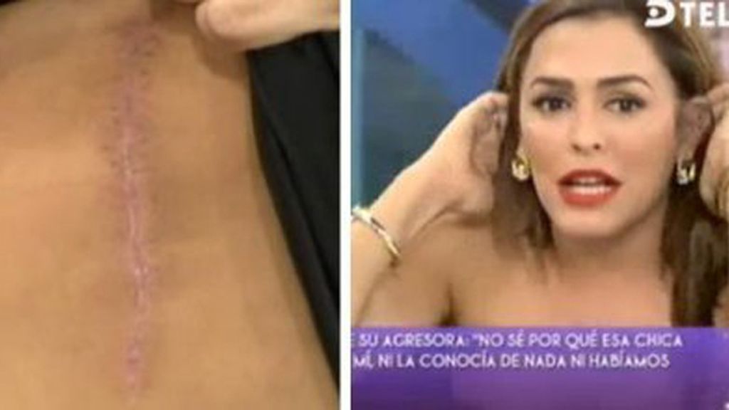 agredidos