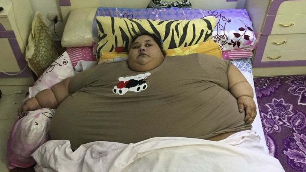 La mujer más obesa del mundo llega a la India para operarse