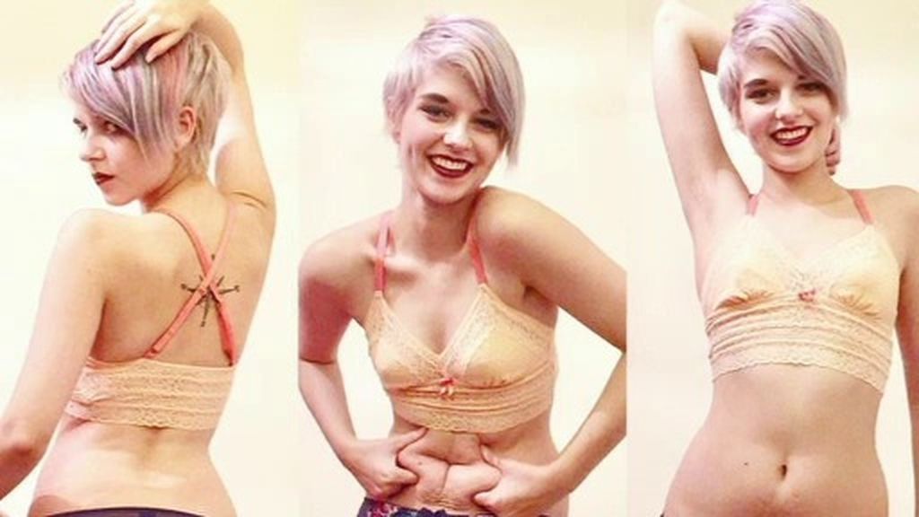 Superó la anorexia... y ha convertido su Instagram en una oda a la vida