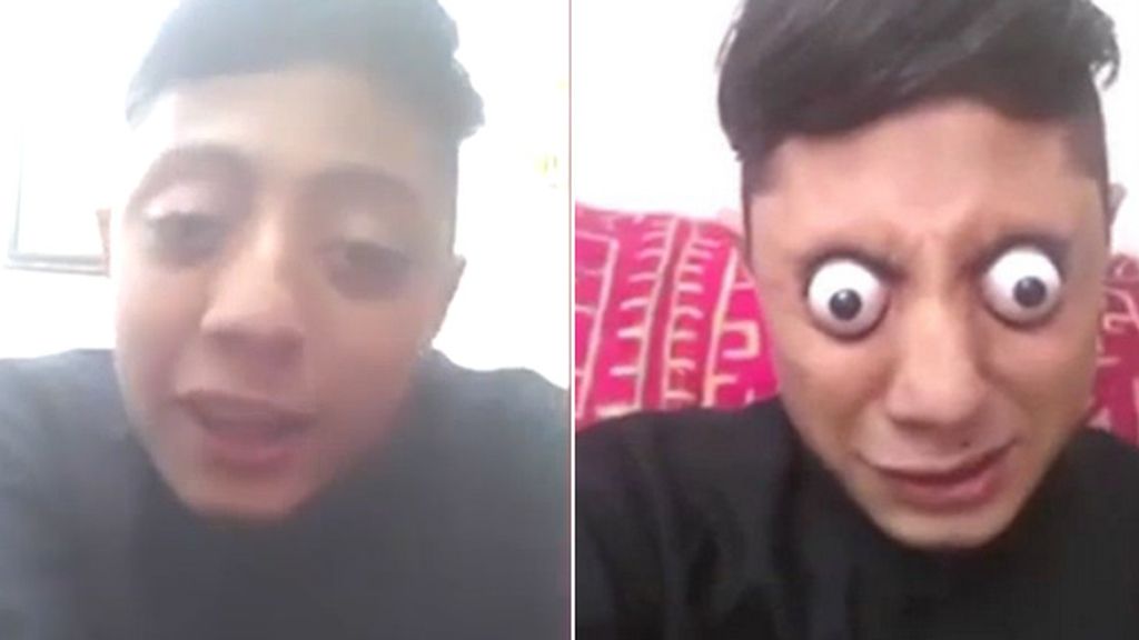 Este joven se saca (literalmente) los ojos