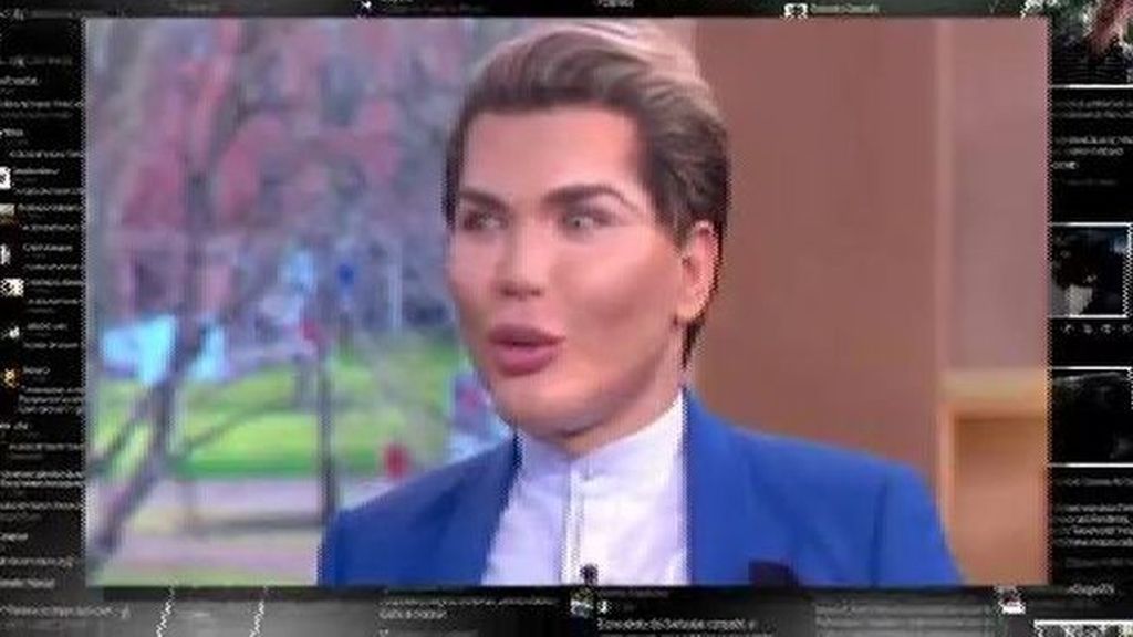 #HoyEnLaRed: el Ken humano alcanza el medio centenar de operaciones estéticas