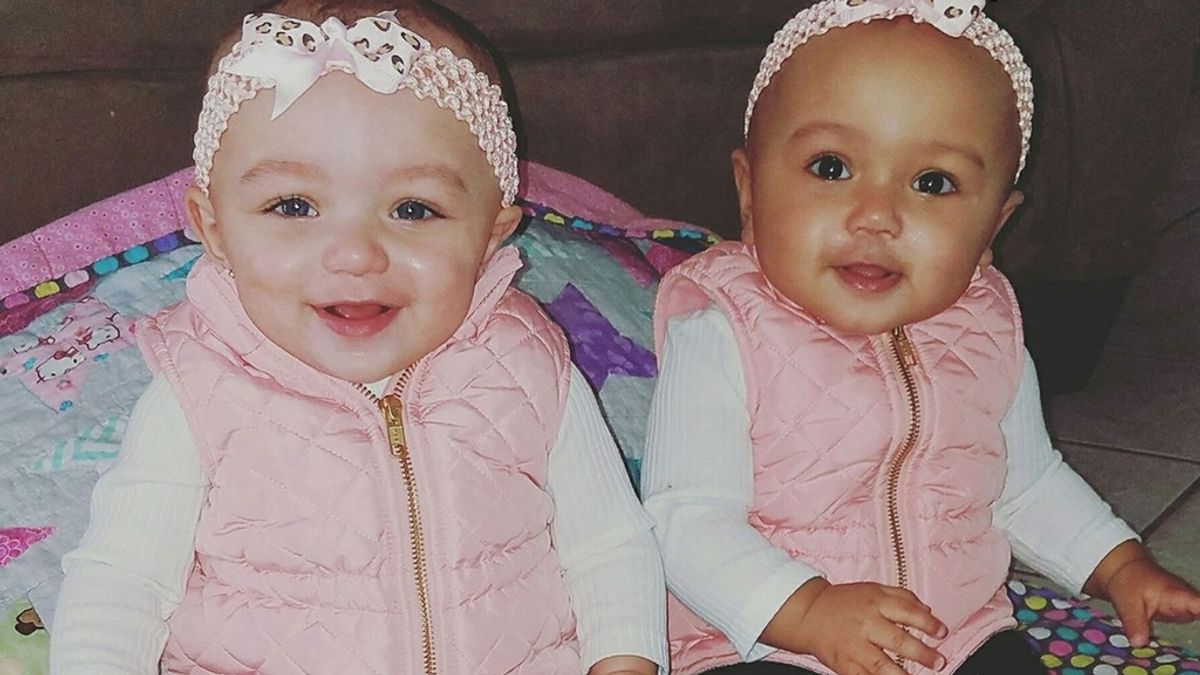 Bebés gemelas de diferente color