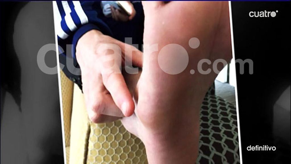 Exclusiva: Así está el pie que no ha dejado a Messi jugar dos partidos con Argentina