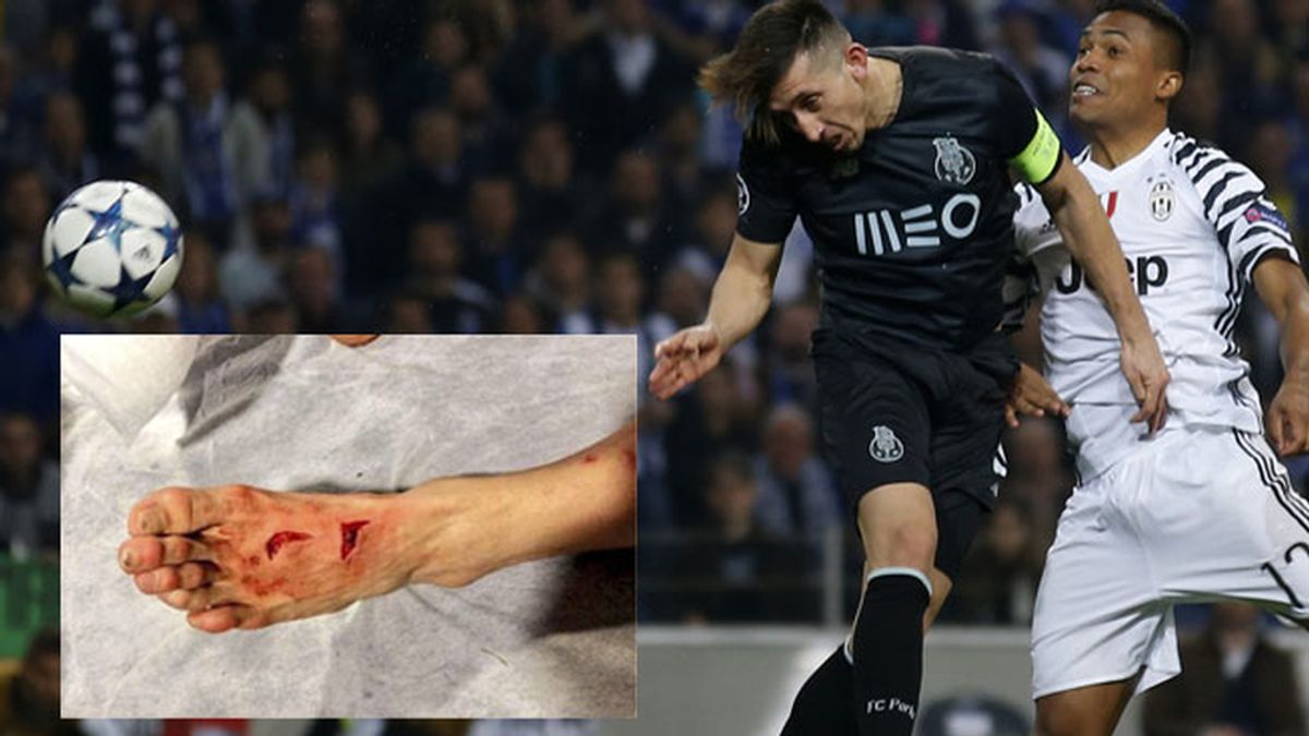 Herrera pie Herrera pie