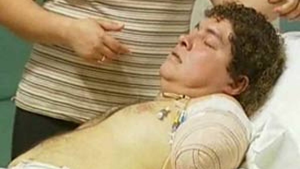 Franns Rilles Melgar perdió su brazo hace unos días mientras trabajaba en una panadería de Valencia. Foto: Informativos Telecinco Franns Rilles Melgar perdió su brazo hace unos días mientras trabajaba en una panadería de Valencia. Foto: Informativos Telecinco