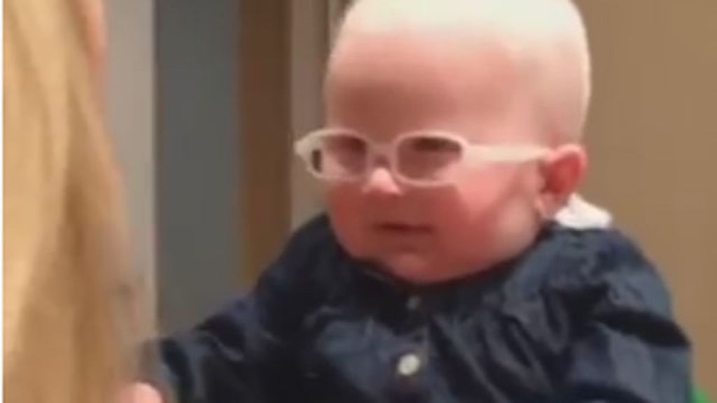 La tierna reacción de una niña albina al ver a su madre por primera vez