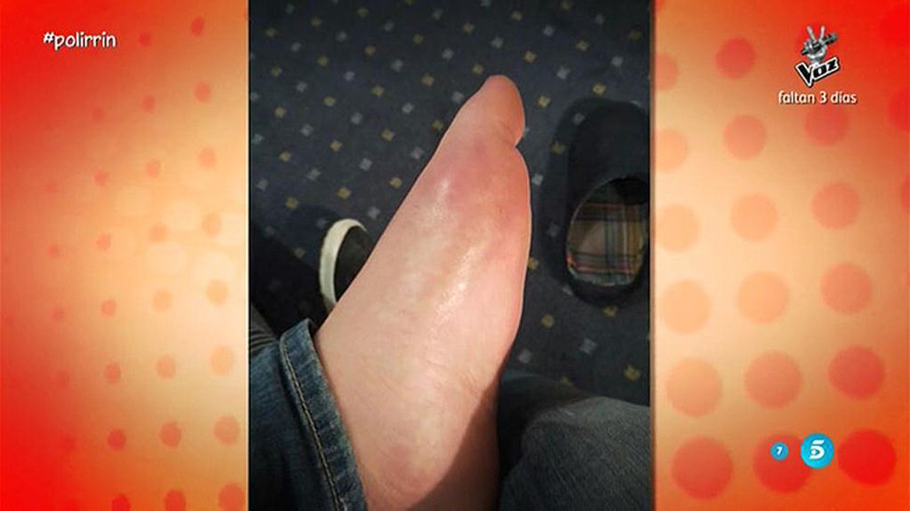 Un ataque de gota, el motivo de la ausencia de Kiko Rivera en 'Gran Hermano VIP'