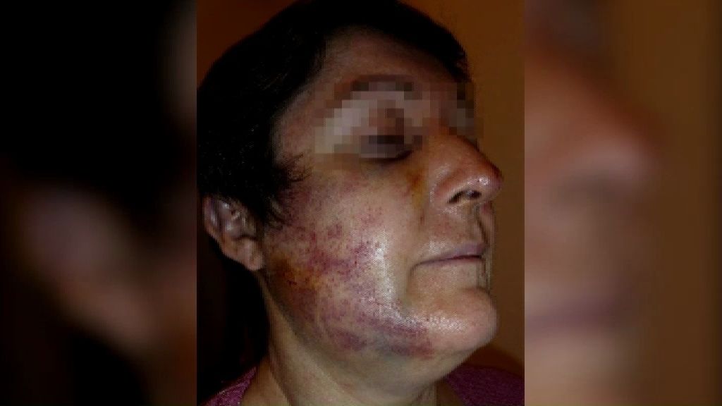 Una mujer sufre una paliza en el atraco a un bar