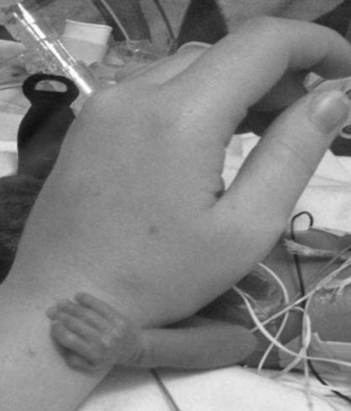 El bebé prematuro que agarra a la enfermera