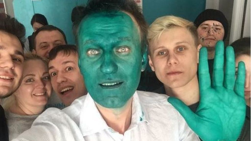 #HoyEnLaRed: la oposición rusa se pinta la cara de verde