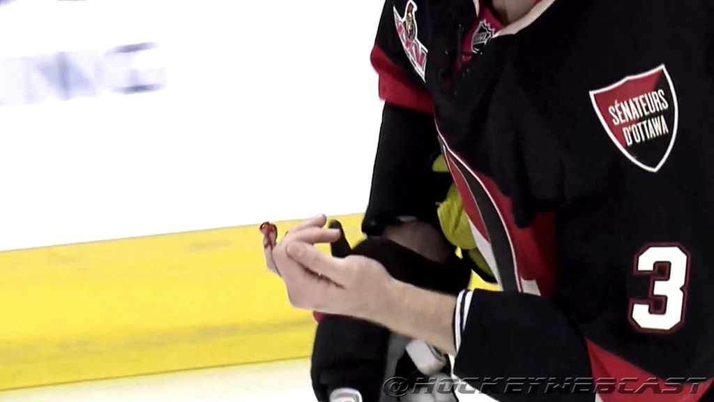dedo roto nhl