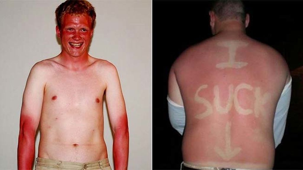 Cuando el sol te marca