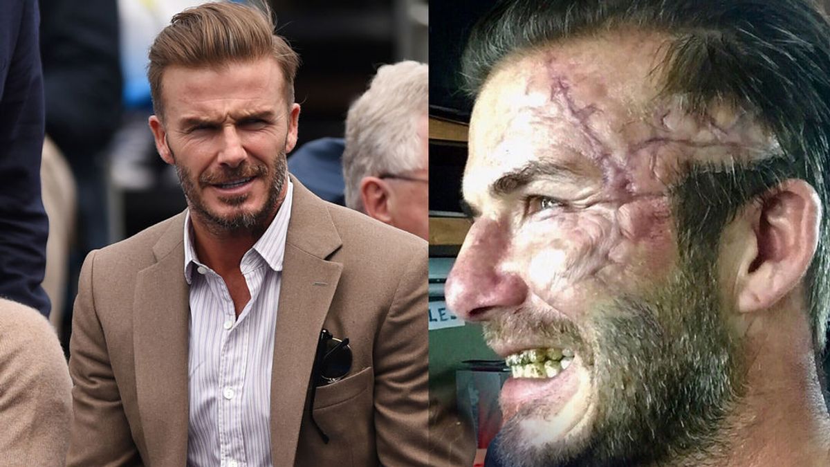 ¿Qué le ha pasado a Beckham? Muestra una escalofriante cicatriz ¿Qué le ha pasado a Beckham? Muestra una escalofriante cicatriz