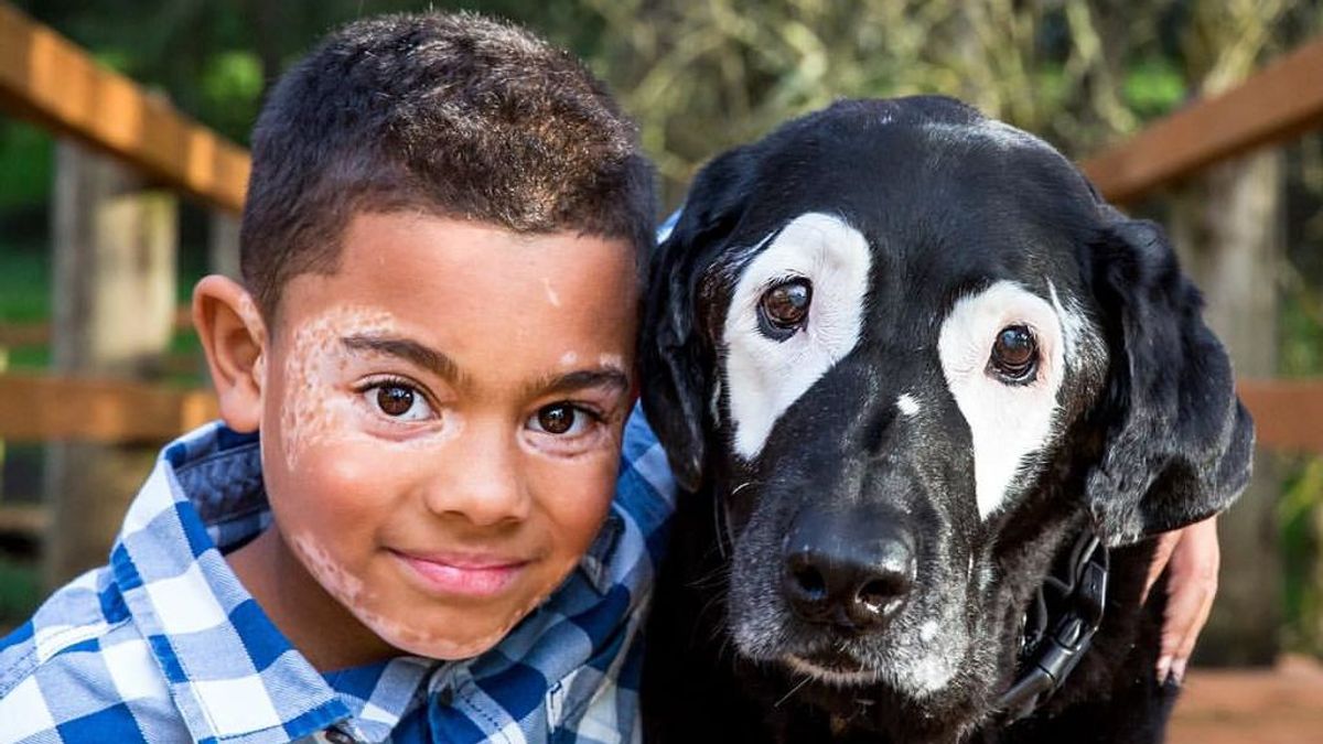 La tierna historia de un niño y un perro con la misma enfermedad