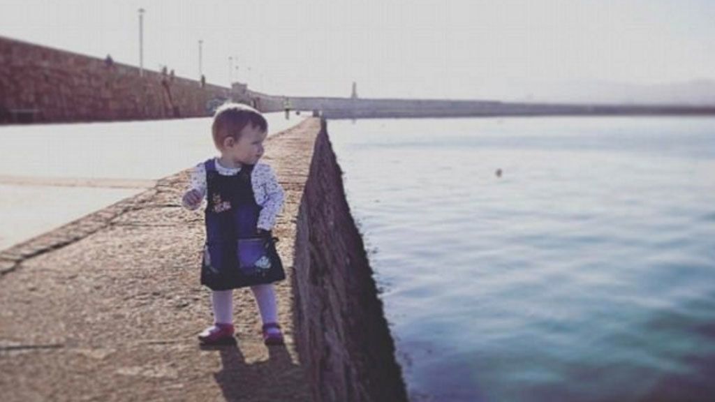 Las fotos de este bebé que dan miedo