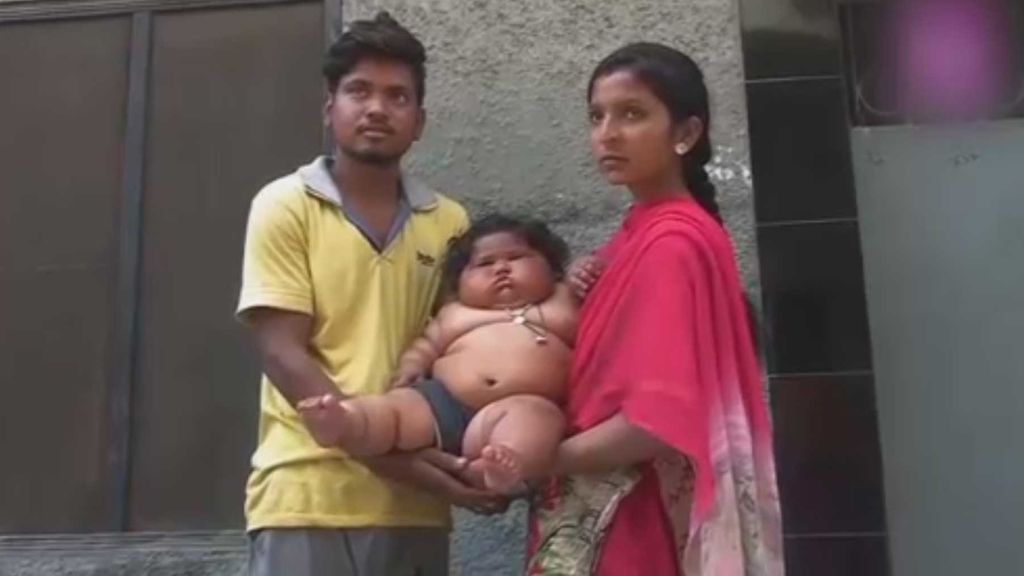 Chahat, la bebé hindú que pesa 17 kilos con solo 8 meses