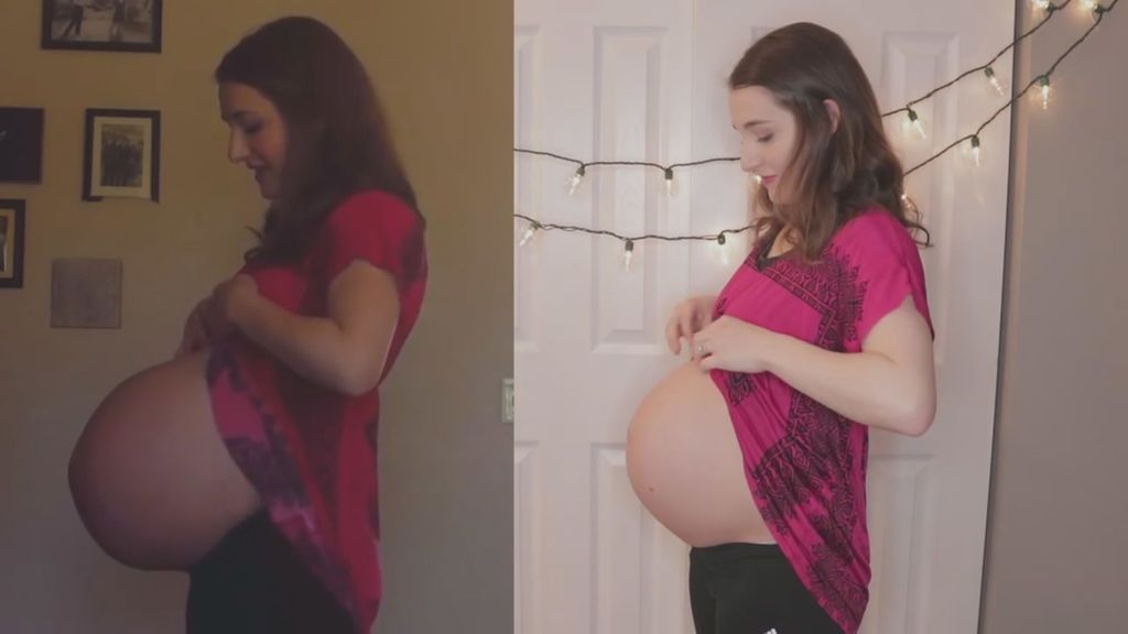 La diferencia entre un embarazo de gemelos y uno normal en la misma mujer