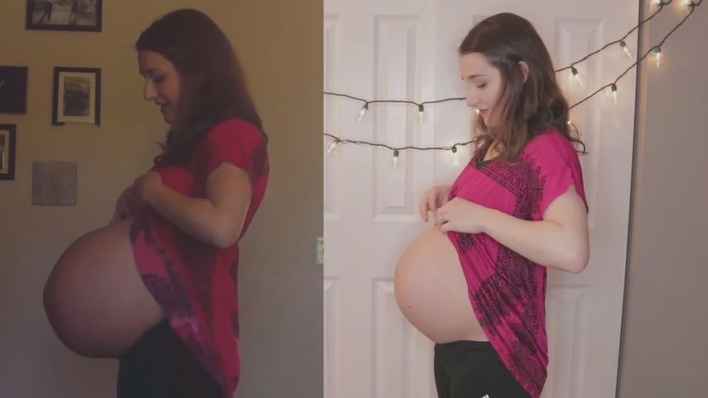 La diferencia entre un embarazo de gemelos y uno normal en la misma mujer