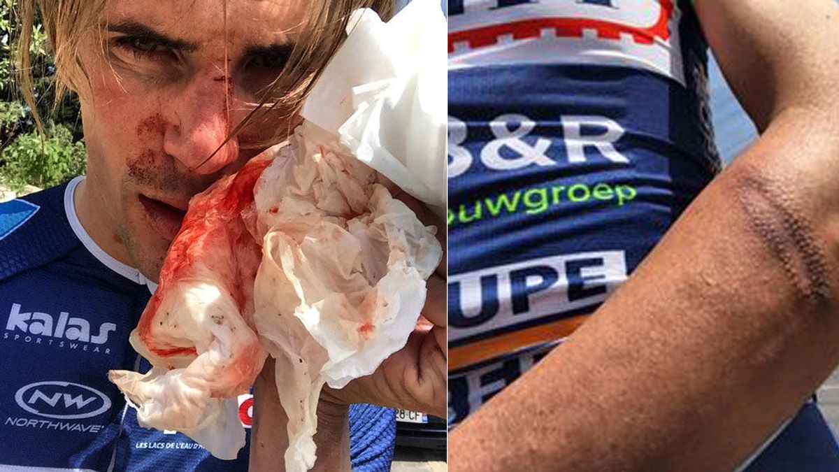 Un agresor ataca con un bate y un cuchillo al ciclista Yoann Offredo mientras entrena